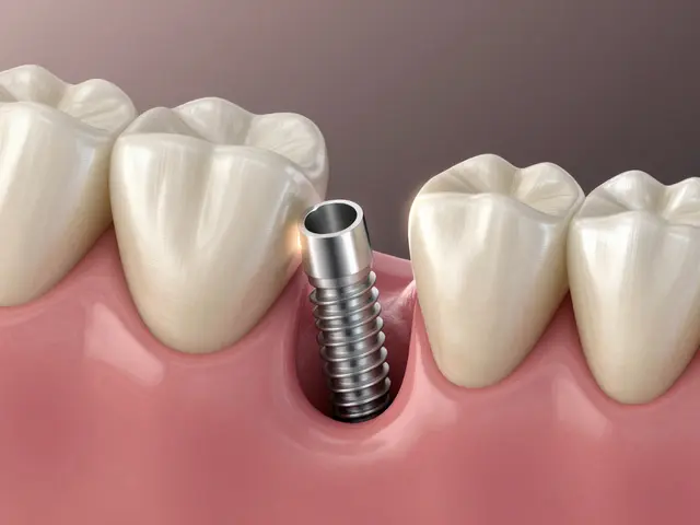 Jak dlouho se hojí zubní implantáty? Průběh hojení a co ovlivňuje rychlost