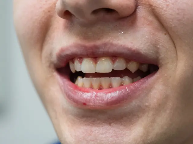 Jak poznám, že mi roste zub moudrosti? Příznaky, co dělat a kdy jít k stomatologovi