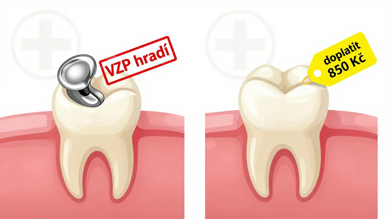 Side-by-side visual comparison of silver and white dental fillings with cost difference indicated visually.