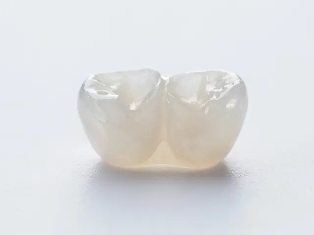 Fazety na přední zuby: Kompletní průvodce výběrem a péčí