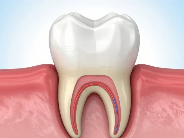 Jak dlouho bolí vytržený nerv a co dělat s bolestí po zákroku