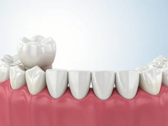 Jak nahradit jeden chybějící zub: Přehled nejlepších metod pro 2026