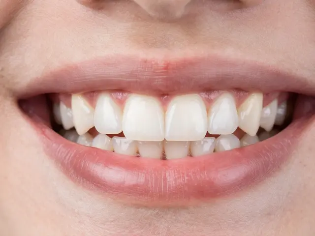 Zubní fazety: Kompletní průvodce přípravou a průběhem procedury