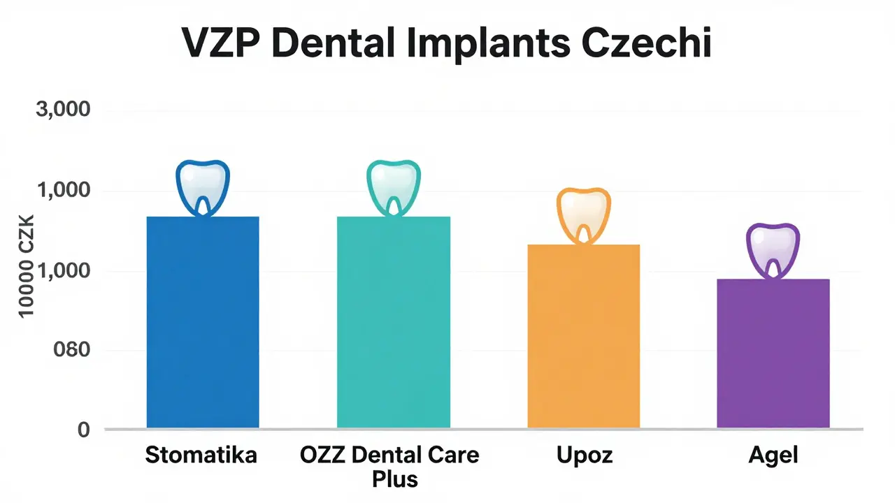 Která pojišťovna přispívá na zubní implantáty v roce 2026? Kompletní přehled